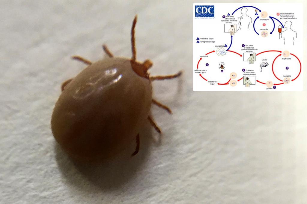 What is babesiosis? The potentially deadly disease is on the rise